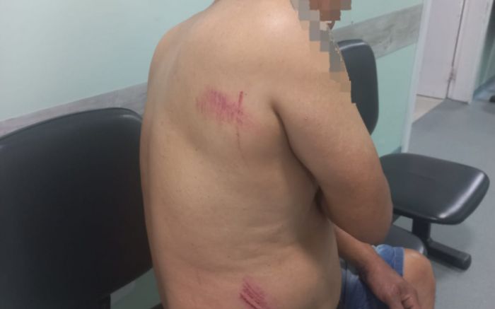 Homem teve um dos braços quebrados na agressão (Foto: Divulgação)