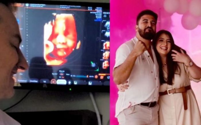 Registro de ultrassom soma mais de três milhões de reproduções
(Foto: Reprodução/Redes sociais)