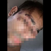 Morador do Nilo Bittencourt denuncia que foi agredido pela PM 