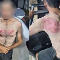 Prefeitura de BC é condenada a pagar R$ 100 mil a homem com deficiência agredido por guardas