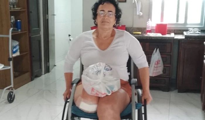 Sandra Pitta perdeu a perna direita