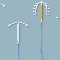 Alta procura por DIU e Implanon revela mudança no planejamento familiar