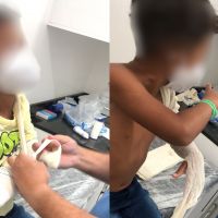 Mãe denuncia escola após filho quebrar o braço e ficar horas sem atendimento