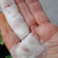 Cadeiras enferrujadas quebram em postinho e deixam idosos feridos