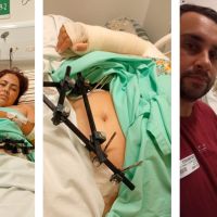 Moradora de Penha precisa de ajuda após acidente grave