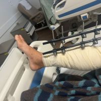 Motorista atacado por venezuelanos é gravemente ferido em Itajaí