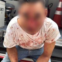 Bêbado é agredido em frente a inferninho de BC