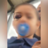 Mãe denuncia creche após filho sofrer pancada forte na cabeça